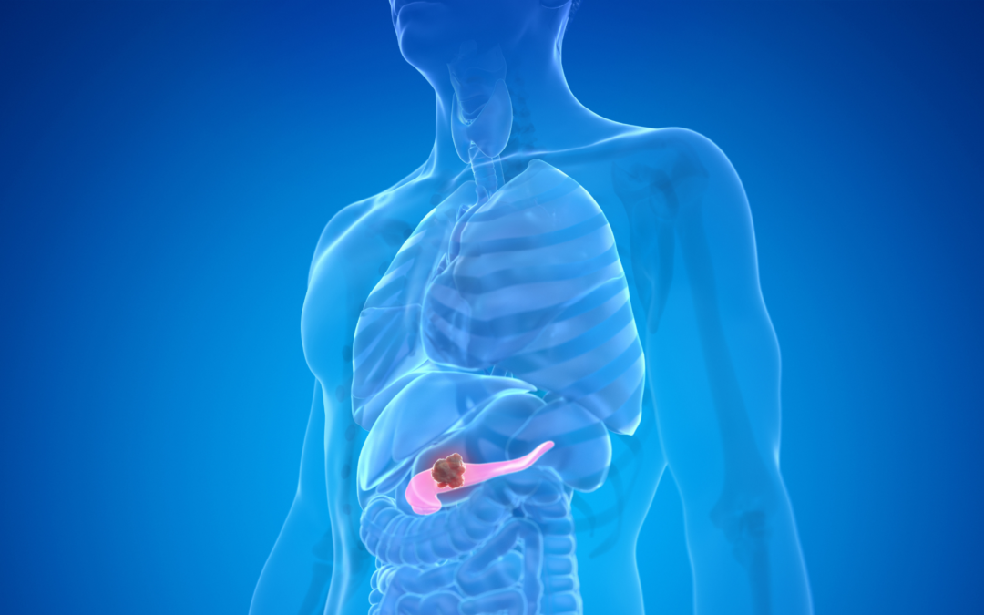 Nueva vía contra el cáncer de páncreas: una investigación española abre una prometedora estrategia terapéutica